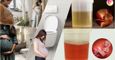 Pregnancy Urine Color