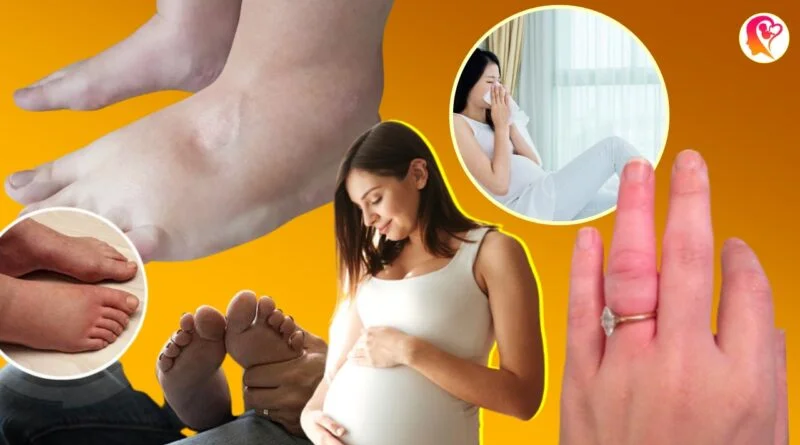 swelling in 8 places during pregnancy