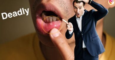 chronic inflammation